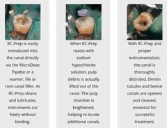 Premier DENTAL RC-Prep Chemo-Mechanical Preparation of Root Canals