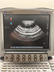 SonoSite M-Turbo Portable Ultrasound System P08189-70w/ P21x/5-1 MHz Transducer