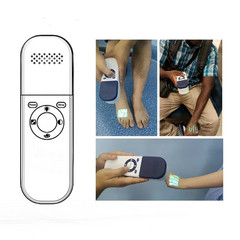 QV500 Infrared Vein Finder – Handheld Vein Detector for Medical & Clinical Use
