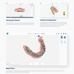 Dental Intra-oral Scanner 3D Real-time Display Software w/Scanning SW AI /Camera