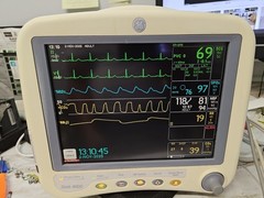 GE Dash 3000 sp02 and soft 7.2 , 4 IBP and Co2 Module , 90 Days Return
