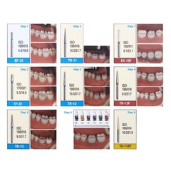 AZDENT Dental High Speed Diamond Burs Crown Preparation Molar Teeth Kit FG-113