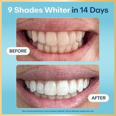 Lumineux Teeth Whitening Strips Kit – 9 Treatments 1 Count (Pack of 9), Clear