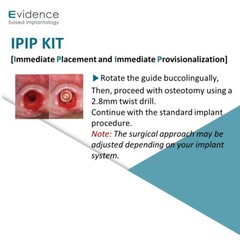 Evidence Implant IPIP Kit