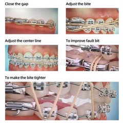 Dental Orthodontic Elastics Chain latex Elastic Ligature Ties Bands for Brackets