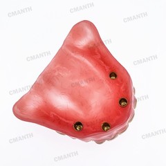 Dental Overdenture Implant Teeth Model Denture with implant Demonstration Pink