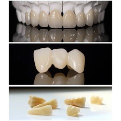 US Dental Emax Glass Ceramic Blocks C14 HT/LT Lithium Disilicate CAD/CAM CEREC
