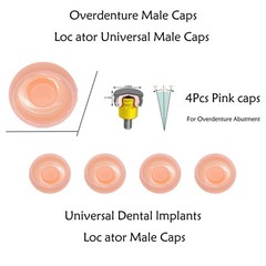 Dental Overdenture Implant Locator Abutment Retention Caps Male Cap Inserts Set