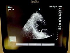 SONOSITE EDGE II 2018 Phased & Linear Transducers. 60 Day Money Back Guarantee