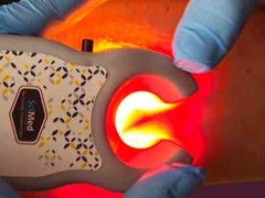 SciMed Pocket Vein Finder Viewer RECHARGEABLE 20 Bright LEDs FDA APPROVED