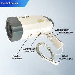 High Quality Digital Colposcopy w/ LCD Screen & Diagnostic Software