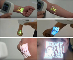 Hospital-Grade Vein Detector Finder 0.5mm Accuracy, Rechargeable, w/ Carry Case